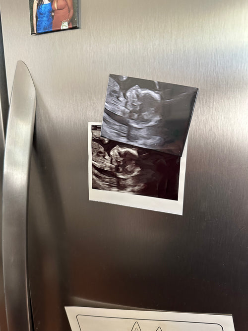 Custom Ultrasound Magnet | Preserve Your Baby’s First Photo