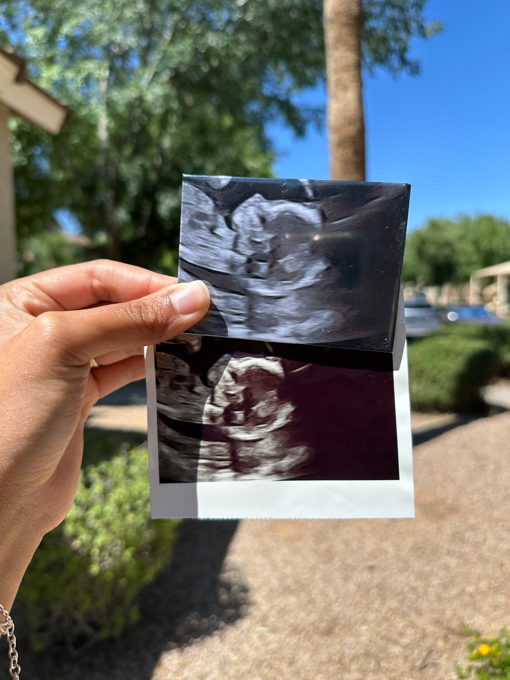 Custom Ultrasound Magnet | Preserve Your Baby’s First Photo