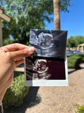 Custom Ultrasound Magnet | Preserve Your Baby’s First Photo
